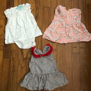 Baby dress bundle